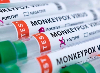 Azərbaycana meymunçiçəyi virusunun müayinəsi üçün testlər gətirildi