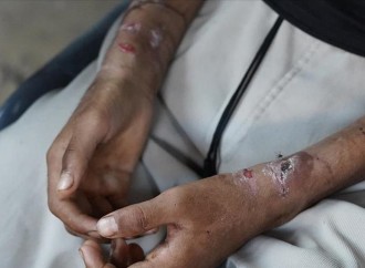 Qəzza qətliamından bir il keçir